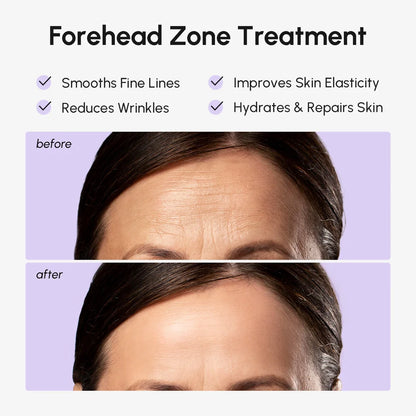 Anti-Wrinkle Forehead Patches – patch applied to forehead